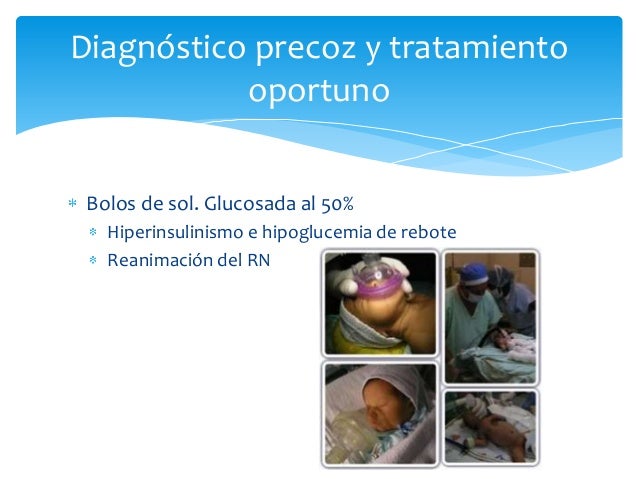 Hipoglucemia neonatal Hipoglucemia neonatal
