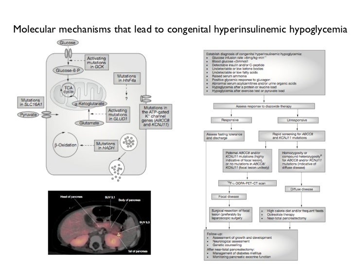 Hipoglucemia post by pass gástrico Hipoglucemia post by pass gástrico