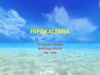 HIPOKALEMIA
Dr Herrera Añazco
Nefrólogo HN2M
ISN - SPN

 