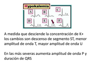 A medida que desciende la concentración de K+
los cambios son descenso de segmento ST, menor
amplitud de onda T, mayor amplitud de onda U
En las más severas aumenta amplitud de onda P y
duración de QRS
 