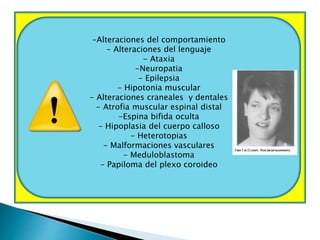 -Alteraciones del comportamiento 
- Alteraciones del lenguaje 
- Ataxia 
-Neuropatia 
- Epilepsia 
- Hipotonia muscular 
- Alteraciones craneales y dentales 
- Atrofia muscular espinal distal 
-Espina bifida oculta 
- Hipoplasia del cuerpo calloso 
- Heterotopias 
- Malformaciones vasculares 
- Meduloblastoma 
- Papiloma del plexo coroideo 
 