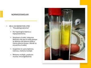 • 285 A 310 MOSM POR LITRO
• “Pseudohiponatremia”
• Por hipertrigliceridemia o
hiperproteinemia.
• Desplazan al sodio, máquinas
detectan más que el sodio porque
se detecta más plasma sólido y
menos plasma acuoso (donde se
encuentra el sodio)
• Sospechar en suero lipémico,
ictéricos, mieloma multiple
• Mieloma multiple, producen
muchas inmunoglobulinas
NORMOOSMOLAR
 