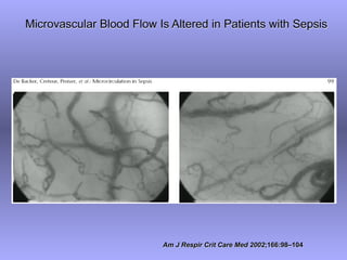 Microvascular Blood Flow Is Altered in Patients with Sepsis




                          Am J Respir Crit Care Med 2002;166:98–104
 