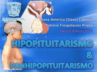 Diana América Chávez Cabrera Patricia Trespalacios Prieto ENDOCRINOLOGIA HIPOPITUITARISMO&PANHIPOPITUITARISMO 