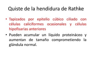 Quiste de la hendidura de Rathke
• Tapizados por epitelio cúbico ciliado con
células caliciformes ocasionales y células
hipofisarias anteriores
• Pueden acumular un líquido proteináceo y
aumentan de tamaño comprometiendo la
glándula normal.
 