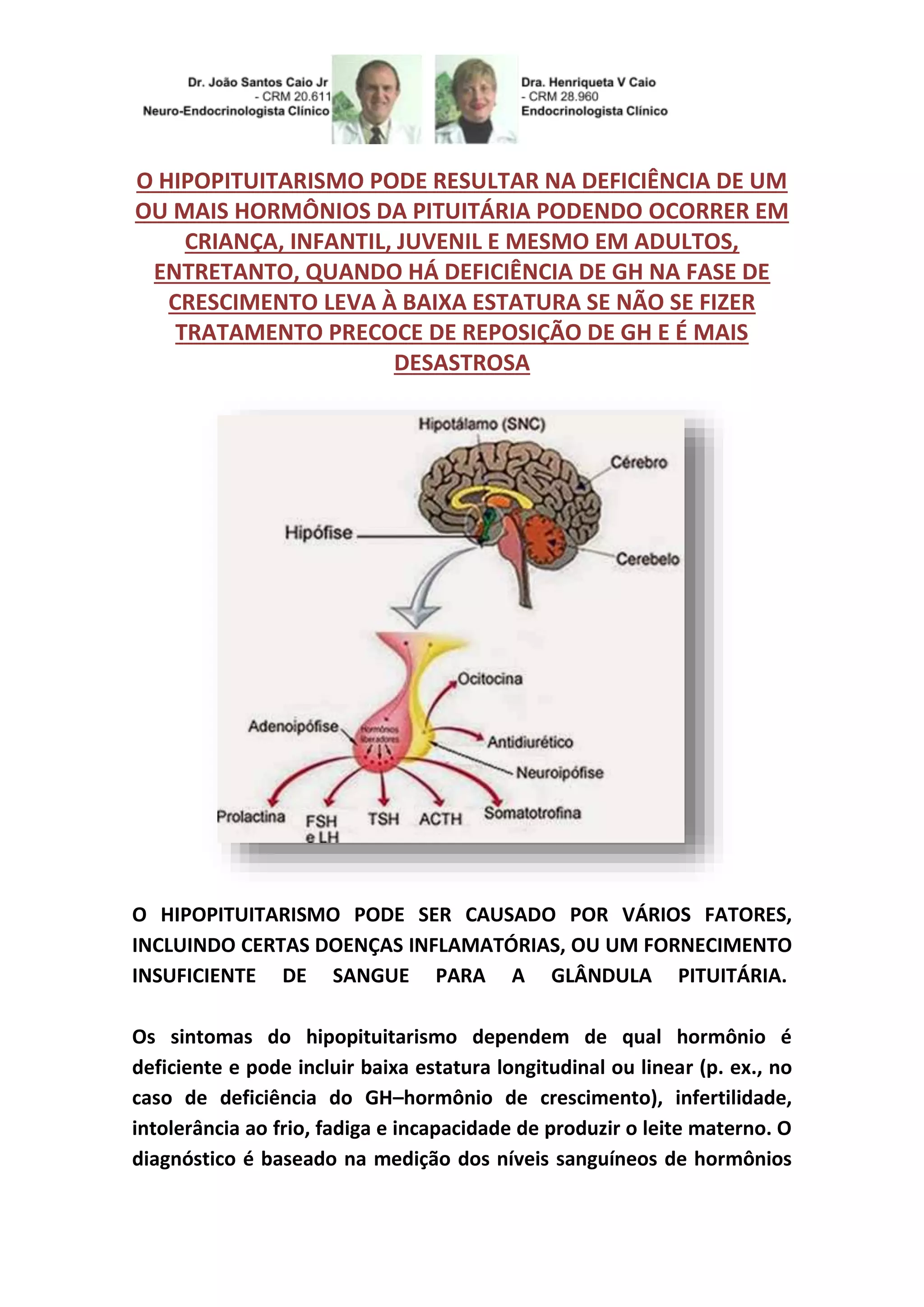 HIPOPITUITARISMO É GLÂNDULA PITUITÁRIA HIPOATIVA | PDF | Download Gratuito