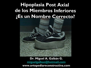 Hipoplasia Post Axial
de los Miembros Inferiores
¿Es un Nombre Correcto?
Dr. Miguel A. Galbán G.
miguelgalban@hotmail.com
www.ortopediareconstructiva.com
 