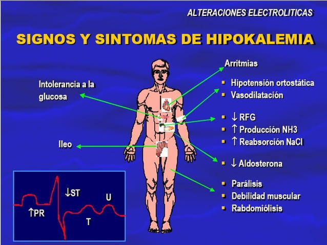 Hipopotasemia hiperpotasemia