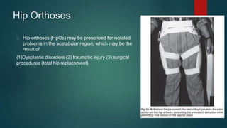 Hip Orthoses
Hip orthoses (HpOs) may be prescribed for isolated
problems in the acetabular region, which may be the
result of
(1)Dysplastic disorders (2) traumatic injury (3) surgical
procedures (total hip replacement)
 