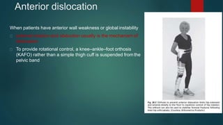 Anterior dislocation
When patients have anterior wall weakness or global instability
external rotation and abduction usually is the mechanism of
dislocation
To provide rotational control, a knee–ankle–foot orthosis
(KAFO) rather than a simple thigh cuff is suspended from the
pelvic band
 