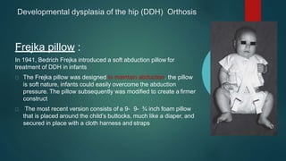 Developmental dysplasia of the hip (DDH) Orthosis
Frejka pillow :
In 1941, Bedrich Frejka introduced a soft abduction pillow for
treatment of DDH in infants
The Frejka pillow was designed to maintain abduction. the pillow
is soft nature, infants could easily overcome the abduction
pressure. The pillow subsequently was modified to create a firmer
construct
The most recent version consists of a 9- 9- ¾ inch foam pillow
that is placed around the child’s buttocks, much like a diaper, and
secured in place with a cloth harness and straps
 