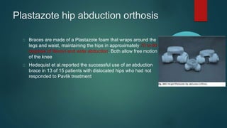 Plastazote hip abduction orthosis
Braces are made of a Plastazote foam that wraps around the
legs and waist, maintaining the hips in approximately 70 to 90
degrees of flexion and wide abduction. Both allow free motion
of the knee
Hedequist et al.reported the successful use of an abduction
brace in 13 of 15 patients with dislocated hips who had not
responded to Pavlik treatment
 