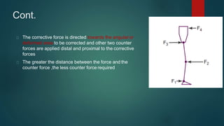 Cont.
The corrective force is directed towards the angular or
deformed area to be corrected and other two counter
forces are applied distal and proximal to the corrective
forces
The greater the distance between the force and the
counter force ,the less counter force required
 