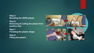 Step 5:
Moulding the HDPE plastic
Step 6:
Removing & Cutting the plastic from
positive cast
Step 7:
Finishing the plastic shape
Step 8:
Fitting the patient
 
