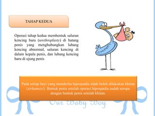 TAHAP KEDUA
Operasi tahap kedua membentuk saluran
kencing baru (urethroplasty) di batang
penis yang menghubungkan lubang
kencing abnormal, saluran kencing di
dalam kepala penis, dan lubang kencing
baru di ujung penis
Pada setiap bayi yang menderita hipospadia tidak boleh dilakukan khitan
(sirkumsisi). Bentuk penis setelah operasi hipospadia sudah serupa
dengan bentuk penis setelah khitan.
 