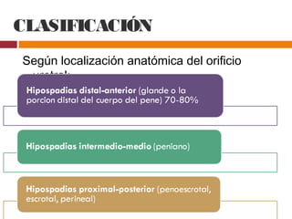 CLASIFICACIÓN
Según localización anatómica del orificio
uretral:
 