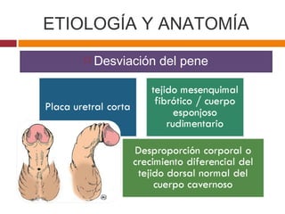 ETIOLOGÍA Y ANATOMÍA
 Desviación del pene
 