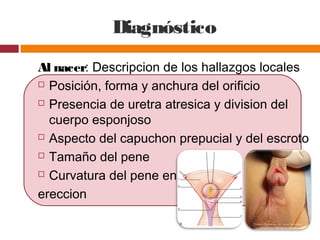 Diagnóstico
Al nacer: Descripcion de los hallazgos locales
 Posición, forma y anchura del orificio
 Presencia de uretra atresica y division del
cuerpo esponjoso
 Aspecto del capuchon prepucial y del escroto
 Tamaño del pene
 Curvatura del pene en
ereccion
 
