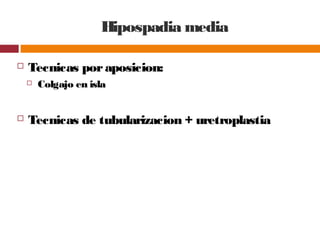 Hipospadia media
 Tecnicas poraposicion:
 Colgajo en isla
 Tecnicas de tubularizacion + uretroplastia
 