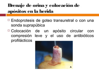 Drenaje de orina y colocación de
apósitos en la herida
 Endoprotesis de goteo transuretral o con una
sonda suprapúbica
 Colocación de un apósito circular con
compresión leve y el uso de antibióticos
profilácticos
 