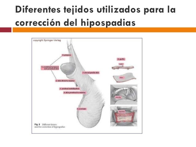 El ejercicio para aumentar el miembro