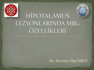 Dr. Devrim Ulaş URUT HİPOTALAMUS LEZYONLARINDA MRG ÖZELLİKLERİ 