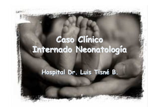 Caso Clínico
Internado Neonatología

  Hospital Dr. Luis Tisné B.
 