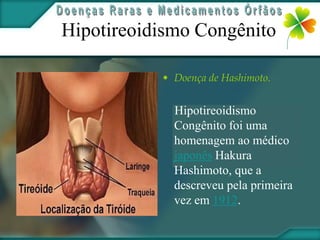 Hipotireoidismo Congênito

           • Doença de Hashimoto.


             Hipotireoidismo
             Congênito foi uma
             homenagem ao médico
             japonês Hakura
             Hashimoto, que a
             descreveu pela primeira
             vez em 1912.
 