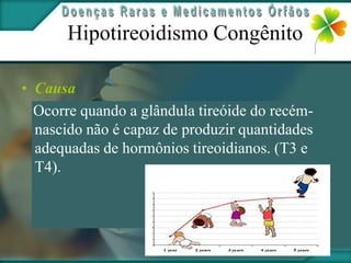Hipotireoidismo Congênito

• Causa
  Ocorre quando a glândula tireóide do recém-
  nascido não é capaz de produzir quantidades
  adequadas de hormônios tireoidianos. (T3 e
  T4).
 