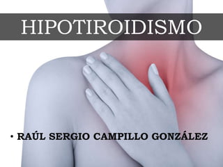 HIPOTIROIDISMO
• RAÚL SERGIO CAMPILLO GONZÁLEZ
 