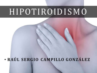 HIPOTIROIDISMO
• RAÚL SERGIO CAMPILLO GONZÁLEZ
 