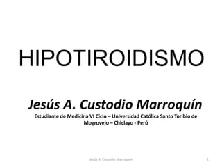 HIPOTIROIDISMO 1 Jesús A. Custodio Marroquín Jesús A. Custodio Marroquín Estudiante de Medicina VI Ciclo – Universidad Católica Santo Toribio de Mogrovejo – Chiclayo - Perú 