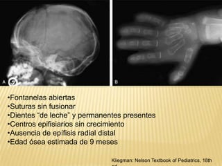 No recibió tratamiento