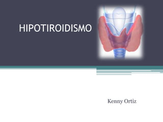 HIPOTIROIDISMO
Kenny Ortiz
 