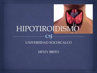 UNIVERSIDAD XOCHICALCO
MITZY BRITO

 