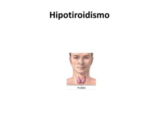 Hipotiroidismo
 