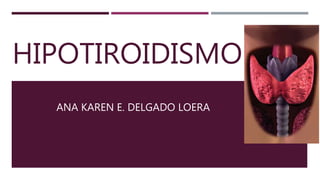 HIPOTIROIDISMO
ANA KAREN E. DELGADO LOERA
 