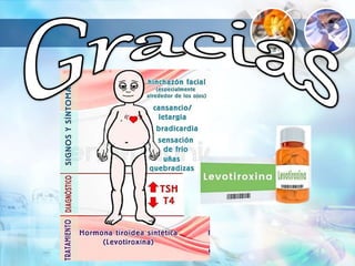 Hipotiroidismo.pptx
