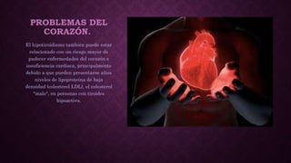 PROBLEMAS DEL
CORAZÓN.
El hipotiroidismo también puede estar
relacionado con un riesgo mayor de
padecer enfermedades del corazón e
insuficiencia cardíaca, principalmente
debido a que pueden presentarse altos
niveles de lipoproteína de baja
densidad (colesterol LDL), el colesterol
"malo", en personas con tiroides
hipoactiva.
 