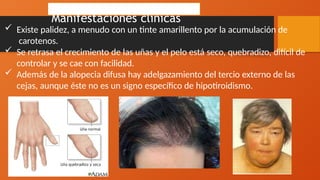  Existe palidez, a menudo con un tinte amarillento por la acumulación de
carotenos.
 Se retrasa el crecimiento de las uñas y el pelo está seco, quebradizo, difícil de
controlar y se cae con facilidad.
 Además de la alopecia difusa hay adelgazamiento del tercio externo de las
cejas, aunque éste no es un signo específico de hipotiroidismo.
Manifestaciones clínicas
 