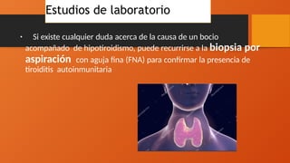 • Si existe cualquier duda acerca de la causa de un bocio
acompañado de hipotiroidismo, puede recurrirse a la biopsia por
aspiración con aguja fina (FNA) para confirmar la presencia de
tiroiditis autoinmunitaria
Estudios de laboratorio
 