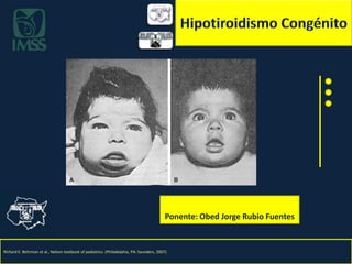Hipotiroidismo Congénito Ponente: Obed Jorge Rubio Fuentes Richard E. Behrman et al., Nelson textbook of pediatrics. (Philadelphia, PA: Saunders, 2007).   