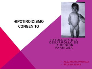 HIPOTIROIDISMO CONGENITO PATOLOGÍA DEL DESARROLLO DE LA REGIÓN FARINGEA  ,[object Object]