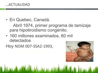 …ACTUALIDADEn Quebec, Canadá.      Abril 1974, primer programa de tamizaje          para hipotiroidismo congénito.160 millones examinados, 60 mil detectadosHoy NOM 007-SSA2-1993,  impacto en salud publica