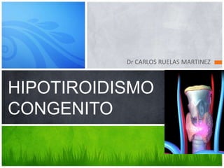 Dr CARLOS RUELAS MARTINEZ HIPOTIROIDISMOCONGENITO 