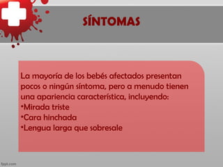 SÍNTOMAS



La mayoría de los bebés afectados presentan
pocos o ningún síntoma, pero a menudo tienen
una apariencia característica, incluyendo:
•Mirada triste
•Cara hinchada
•Lengua larga que sobresale
 