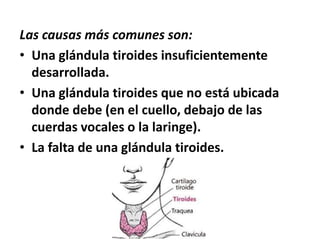 Las causas más comunes son:
• Una glándula tiroides insuficientemente
desarrollada.
• Una glándula tiroides que no está ubicada
donde debe (en el cuello, debajo de las
cuerdas vocales o la laringe).
• La falta de una glándula tiroides.
 
