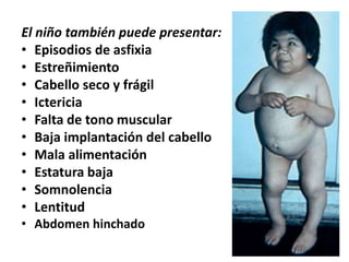 El niño también puede presentar:
• Episodios de asfixia
• Estreñimiento
• Cabello seco y frágil
• Ictericia
• Falta de tono muscular
• Baja implantación del cabello
• Mala alimentación
• Estatura baja
• Somnolencia
• Lentitud
• Abdomen hinchado
 