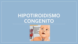 HIPOTIROIDISMO
CONGENITO
 