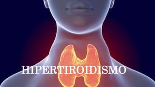 HIPERTIROIDISMO
 